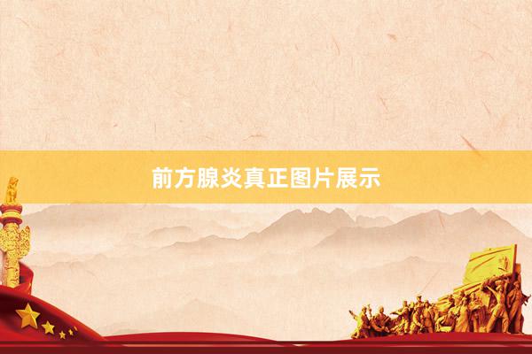 前方腺炎真正图片展示